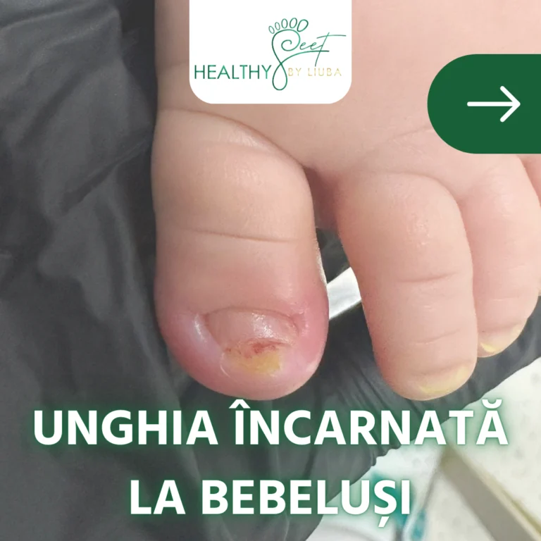De ce este important să îngrijim corect unghiile bebelușilor?